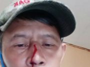 Merasa Dilecehkan dan Dianiaya, Wartawan di Majalengka Polisikan Oknum Ormas