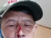 Merasa Dilecehkan dan Dianiaya, Wartawan di Majalengka Polisikan Oknum Ormas