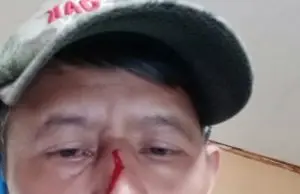 Merasa Dilecehkan dan Dianiaya, Wartawan di Majalengka Polisikan Oknum Ormas