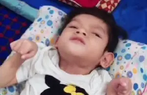 Berbaring Menahan Sakit Kejang-Kejang Diderita Almaira, Anak Perempuan Warga Baranangsiang KBB